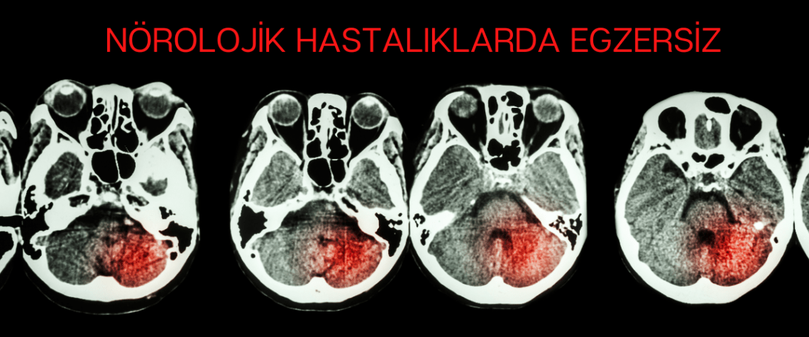 Nörolojik Hastalıklarda Egzersizin Önemi