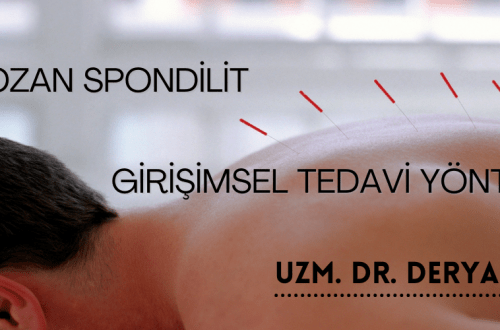 ankilozan spondilit girişimsel tedavi yöntemleri