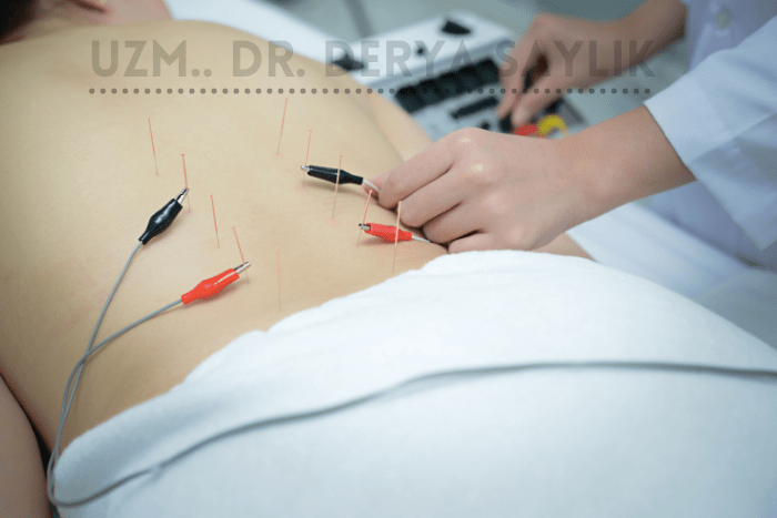 Elektro Akupunktur