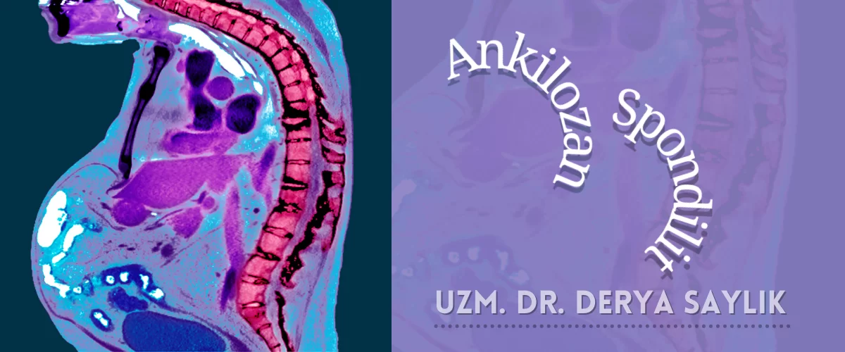 Ankilozan Spondilit