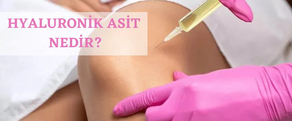 Hyaluronik Asit Nedir?